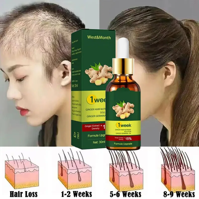 Licorice Root Sticks - Anti-Hair Loss Óleos Essenciais, Produtos para